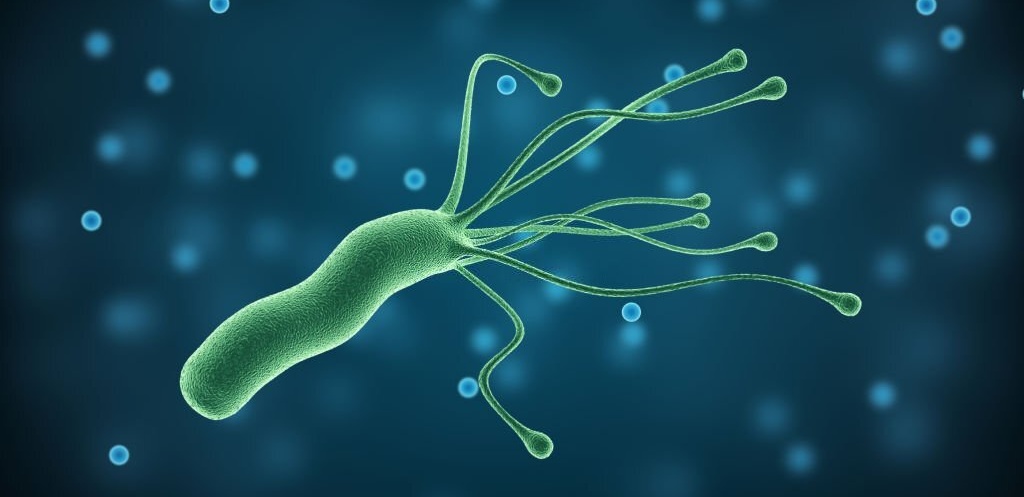  H. Pylori: quando levantar suspeitas?